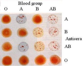 metody krevní skupiny