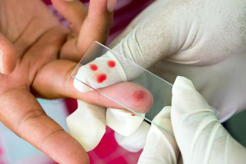 krevní test na parazity