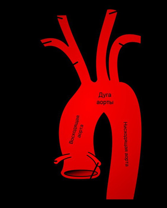 brahiocefalna arterija