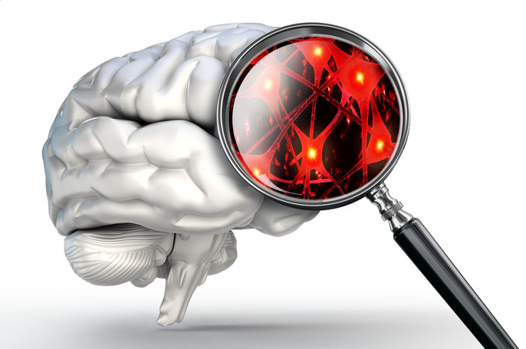 kortikalne atrofije možganov