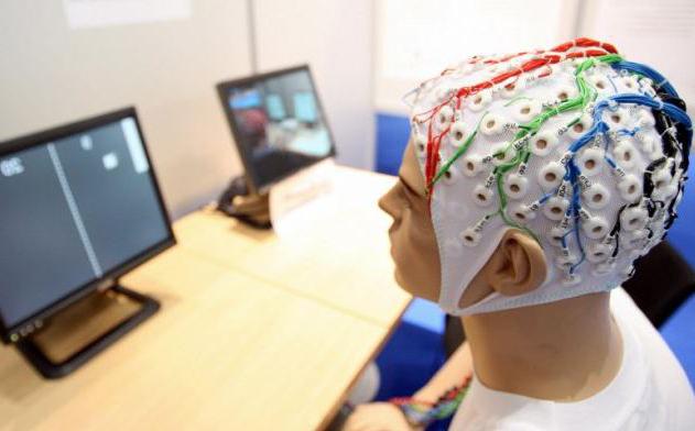 Kje narediti encefalogram možganov