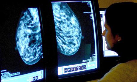 foto di sintomi del cancro al seno