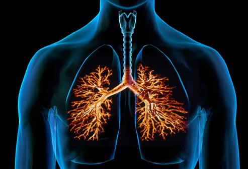 Zdravljenje bronhitisa