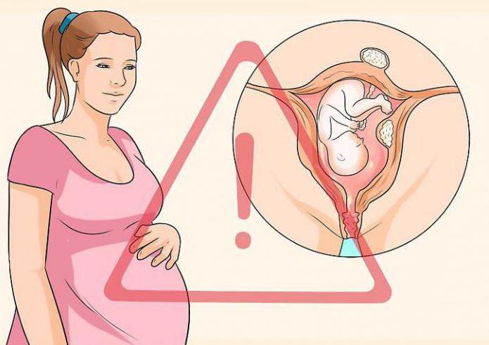 Ендометриозата и маточните фиброиди могат да забременеят