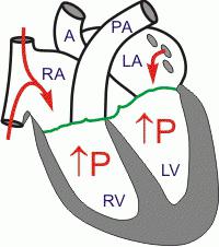 obwód cyklu serca