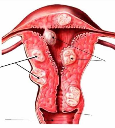 менструация след раждане