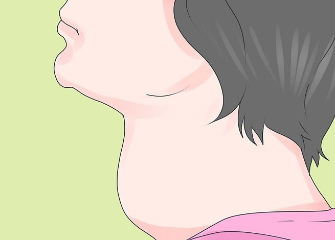 Disfunzione della tiroide