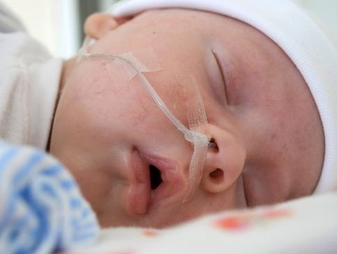 cerebrální ischemie u novorozenců