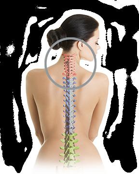 hondroza vratne hrbtenice