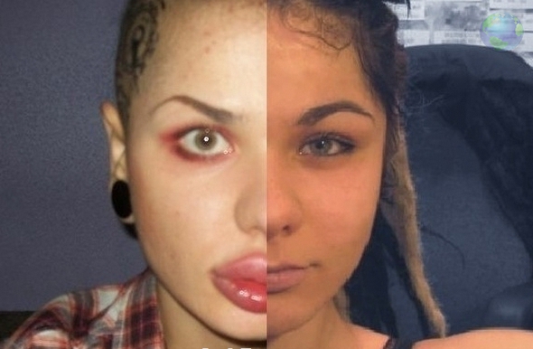 Christina Rey przed i po plastiku
