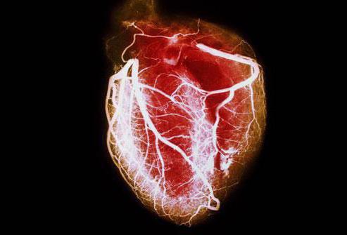 Przewlekłe zalecenia dotyczące niewydolności serca