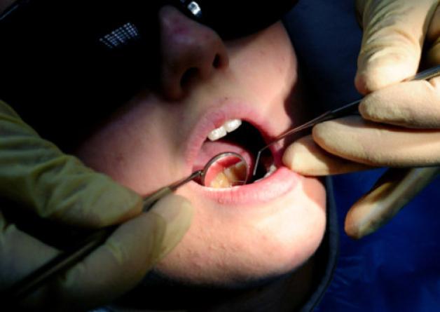 zdravljenje pulpitisa in periodontitisa