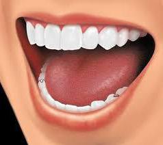 horní částečné zubní protézy