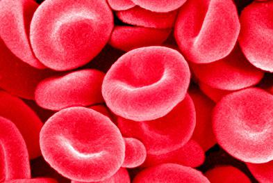classificazione dell'anemia