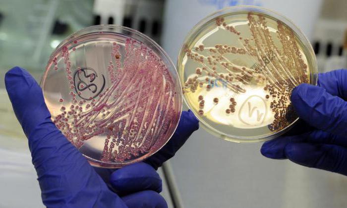 powszechne bakterie grupy coli w wodzie