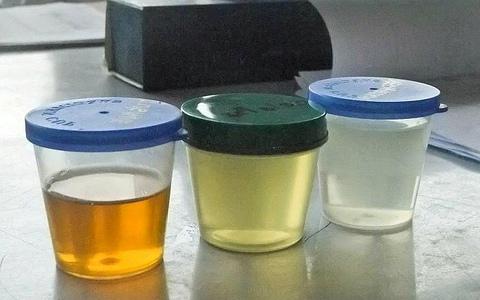 urina incolore