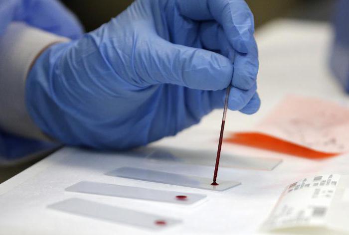 kompletní krevní obraz pro HIV