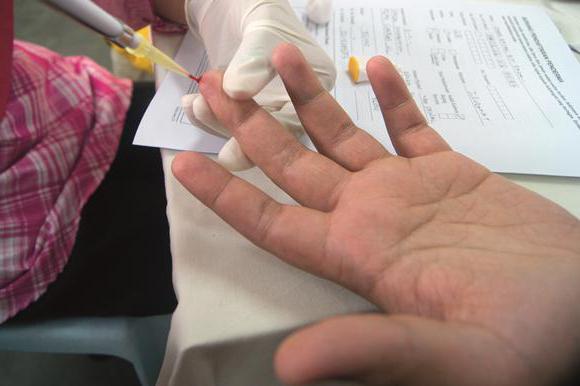 test okužbe s HIV