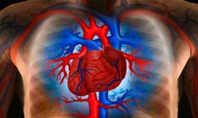 Komplikace infarktu myokardu
