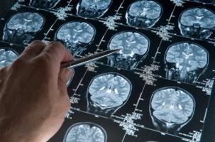 kde dělat mozkovou tomografii