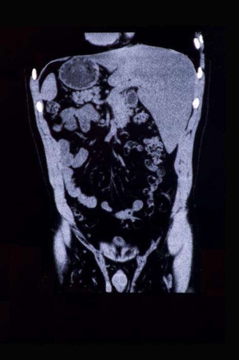 tomografia computerizzata dell'intestino a Mosca
