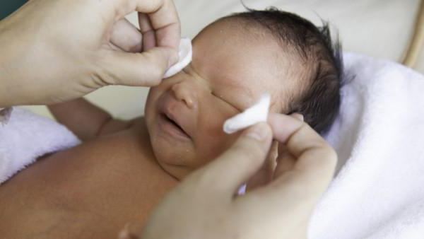 konjunktivitis kod kućnog liječenja novorođenčadi