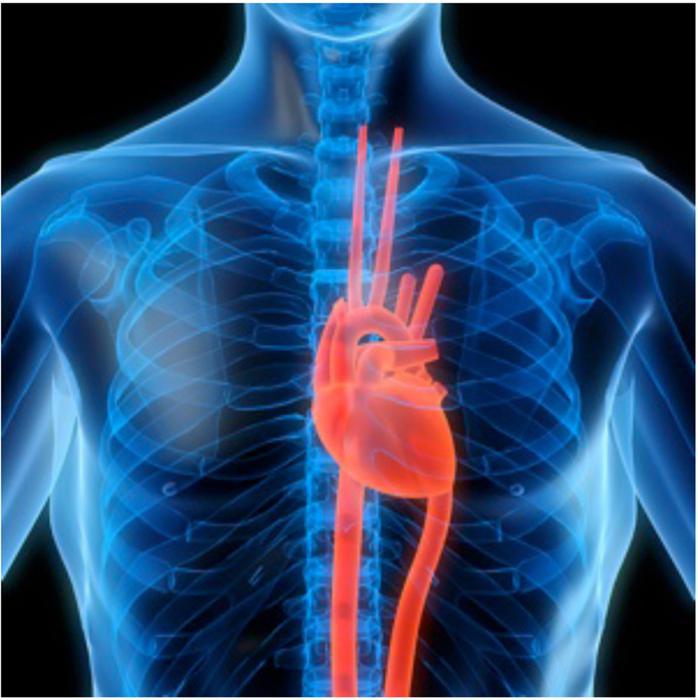 complicanze della chirurgia del bypass cardiaco
