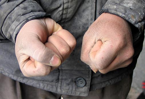 Cracked skin on the hands: příčiny