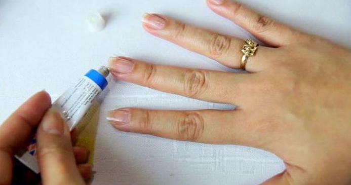 Napuknuta koža na prstima oko liječenja noktiju