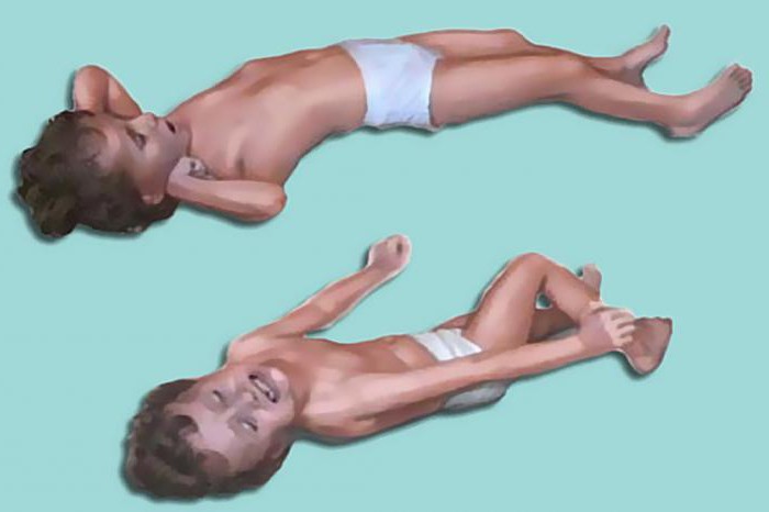 skurcze u dziecka w temperaturze pierwszej pomocy