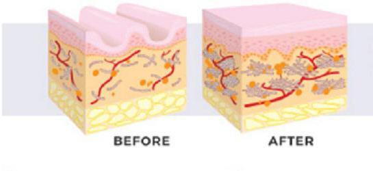 aktivna krema za kožo s hialuronskimi pregledi