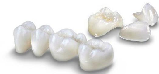 какво корони на зъбите е по-добре да се поставят ревюта