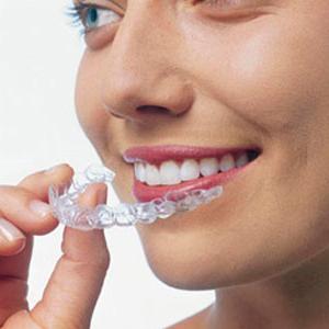 korekcija iskrivljenih zuba