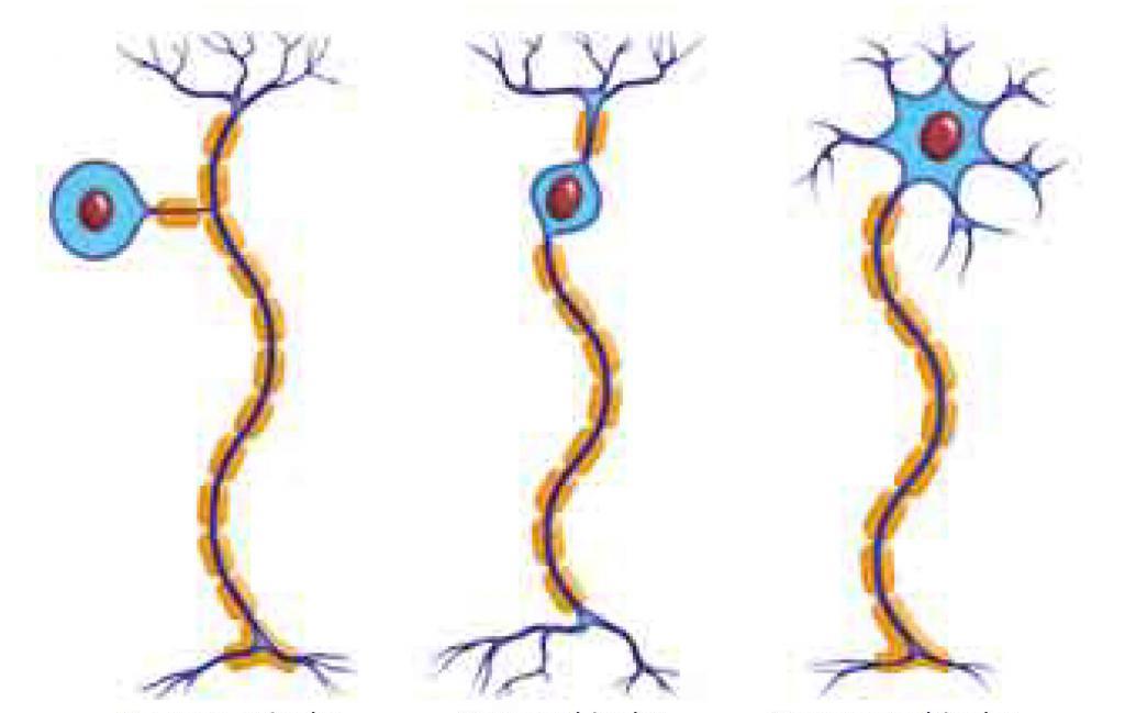 Diversi tipi di neuroni