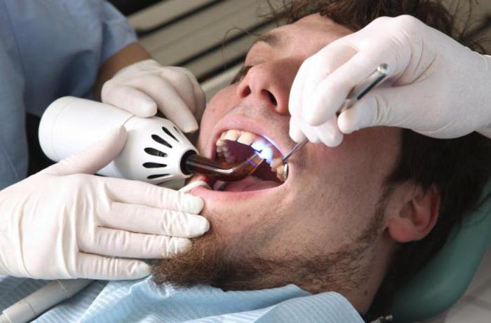 typy zubních výplní