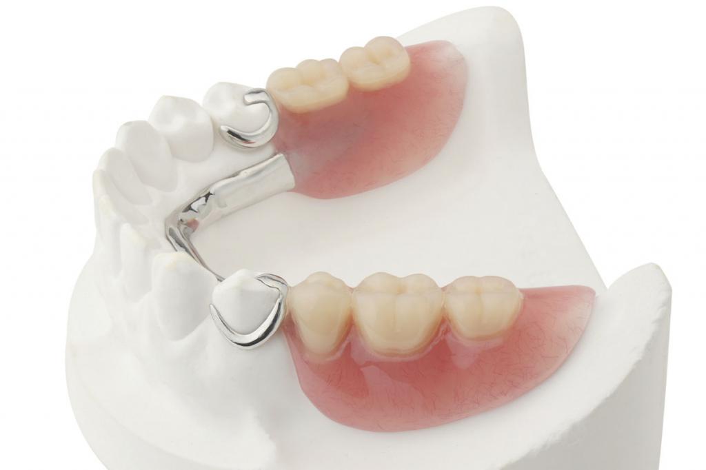 Cast pro částečné zubní protézy