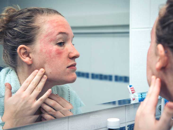 dermatitida na obličejové fotografii u dospělých