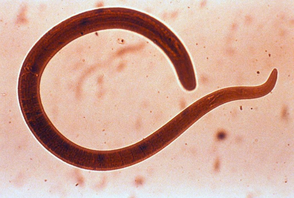 sviluppo del ciclo di vita del nematode umano