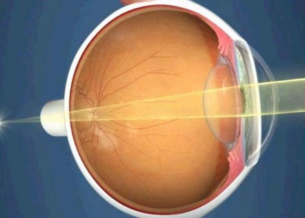 Дијабетичка ретинопатија