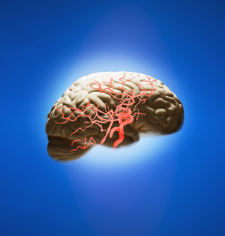 Diabetična lezija možganskih žil
