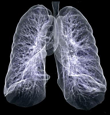 diagnostika astmatu