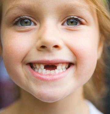 ordine di perdita di denti da latte nei bambini
