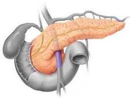 difúzních změn v parenchému pankreatu