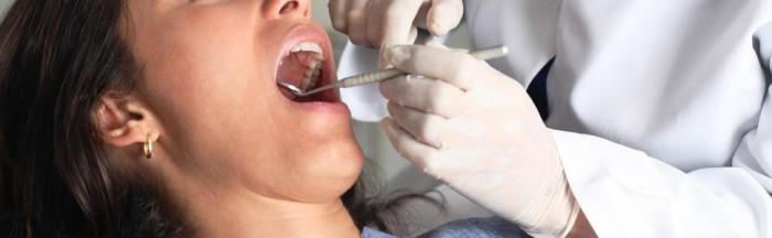 domácí léčba zánětu dásní