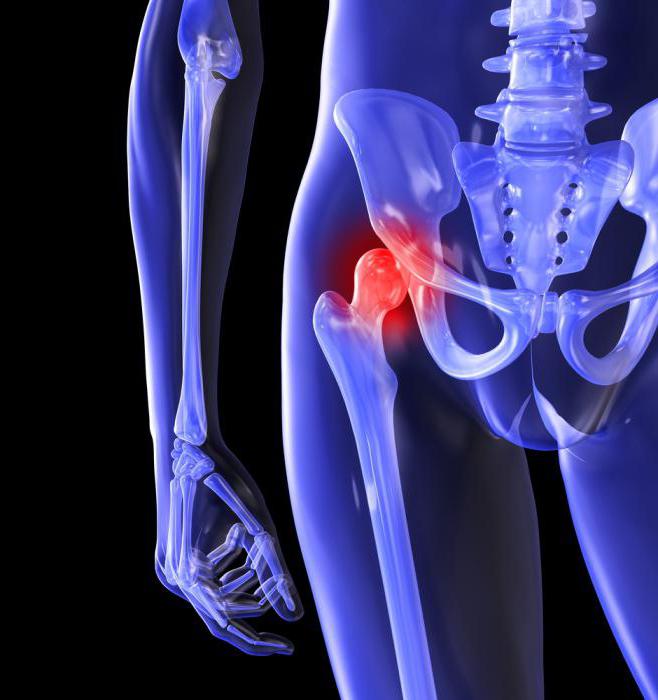Esercizi di trattamento dei sintomi della malattia articolare dell'anca