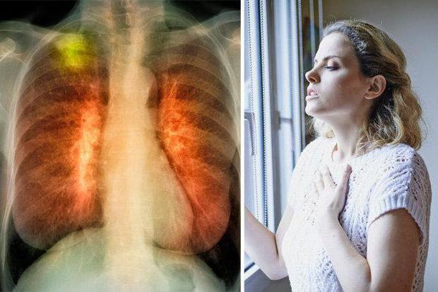 malattia polmonare negli esseri umani