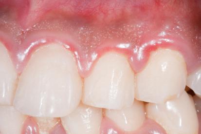 historie zubů