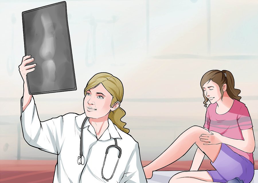 Диагностика на изкълчване на коляното