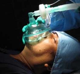 stomatologija opće anestezije
