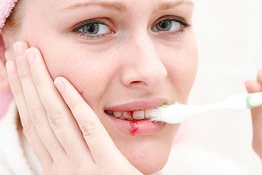 Pri čiščenju zob dlesni krvavijo